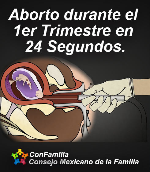 Aborto durante el 1er Trimestre en 24 Segundos.